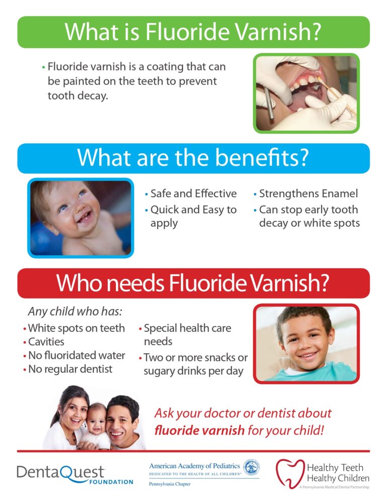 Educational poster explaining fluoride varnish benefits for children.